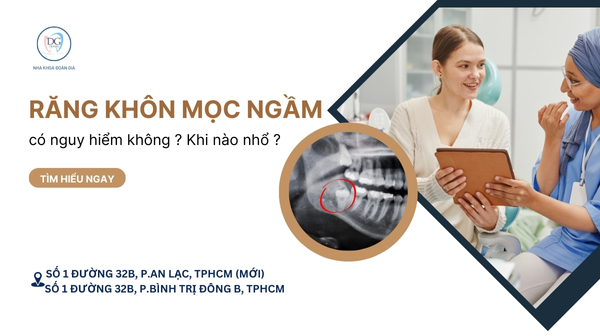 1. RĂNG KHÔN MỌC NGẦM CÓ NGUY HIỂM KHÔNG  KHI NÀO CẦN NHỔ