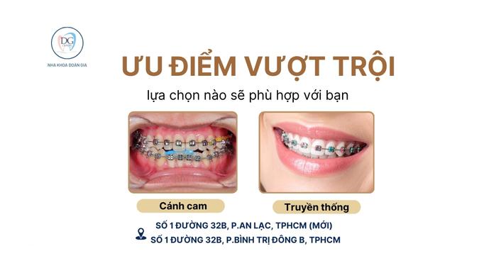 1. ƯU ĐIỂM VƯỢT TRỘI CỦA NIỀNG MẮC CÀI CÁNH CAM SO VỚI TRUYỀN THỐNG
