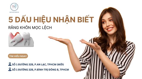 11. 5 DẤU HIỆU NHẬN BIẾT RĂNG KHÔN MỌC LỆCH CẦN NHỔ SỚM