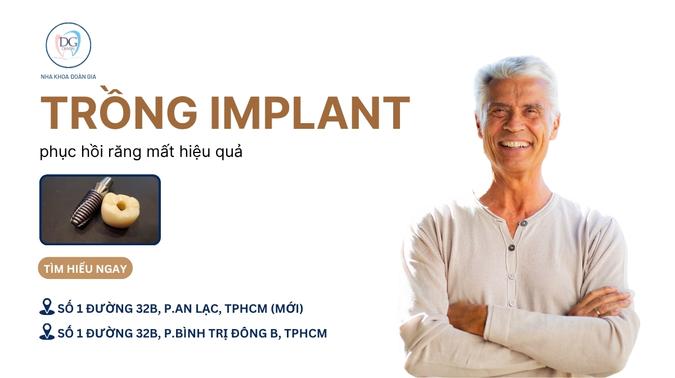 11. CẤY GHÉP IMPLANT  GIẢI PHÁP PHỤC HỒI RĂNG MẤT HIỆU QUẢ