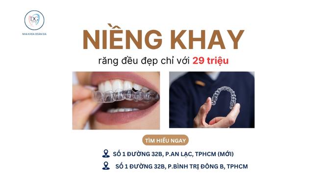 11. RĂNG ĐỀU ĐẸP CÙNG KHAY TRONG SUỐT CHỈ VỚI 29 TRIỆU
