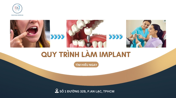 12. QUY TRÌNH LÀM IMPLANT