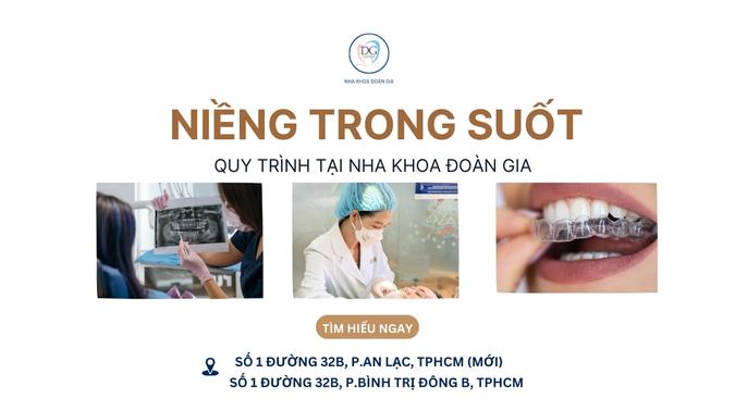 12. TRÌNH TỰ NIỀNG RĂNG TRONG SUỐT TẠI PHÒNG NHA UY TÍN