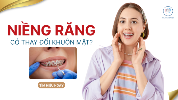 13. NIỀNG RĂNG THAY ĐỔI GƯƠNG MẶT NHƯ THẾ NÀO   SỰ THẬT NHIỀU NGƯỜI BẤT NGỜ
