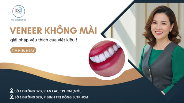 13. VENEER KHÔNG MÀI RĂNG  GIẢI PHÁP YÊU THÍCH CỦA PHỤ NỮ VIỆT KIỀU