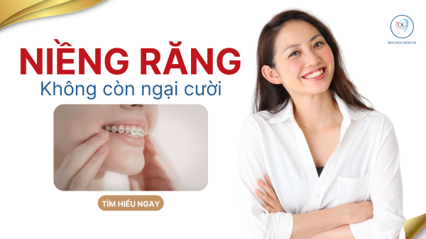 14. NIỀNG RĂNG KHÔNG CÒN NGẠI CƯỜI