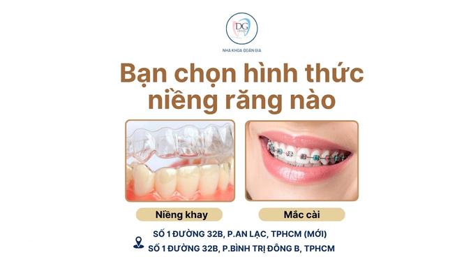 15. NIỀNG KHAY CÓ TỐT HƠN MẮC CÀI