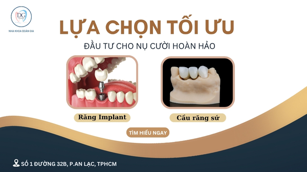 18. LỰA CHỌN TỐI ƯU ĐẦU TƯ CHO NỤ CƯỜI HOÀN HẢO