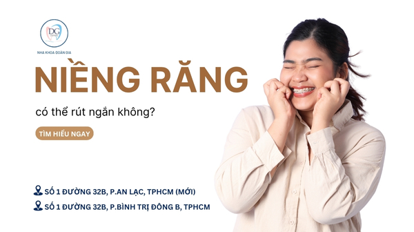 18. NIỀNG RĂNG MẤT BAO LÂU  CÓ RÚT NGẮN ĐƯỢC THỜI GIAN KHÔNG