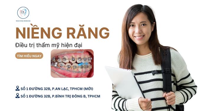 2. NIỀNG RĂNG MẮC CÀI CÁNH CAM CÔNG NGHỆ ĐIỀU TRỊ THẨM MỸ HIỆN ĐẠ