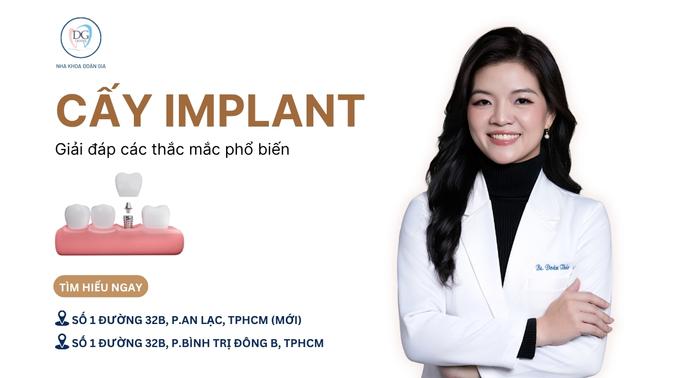 20. GIẢI ĐÁP CÁC THẮC MẮC PHỔ BIẾN VỀ CẤY GHÉP IMPLANT