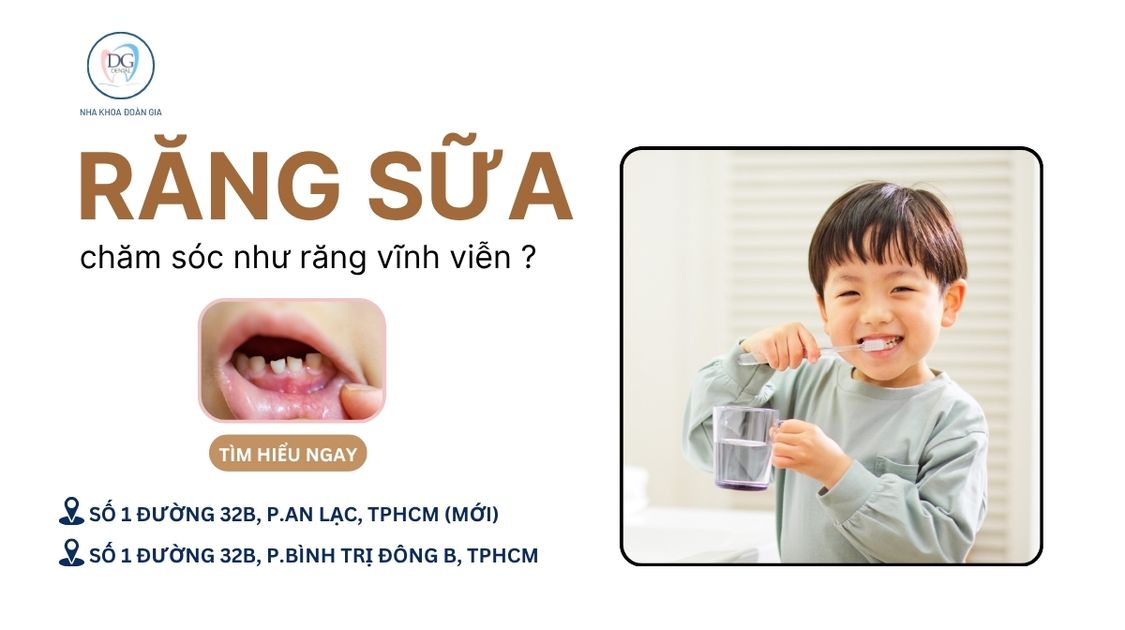 21. RĂNG SỮA CÓ CẦN CHĂM SÓC NHƯ RĂNG VĨNH VIỄN KHÔNG