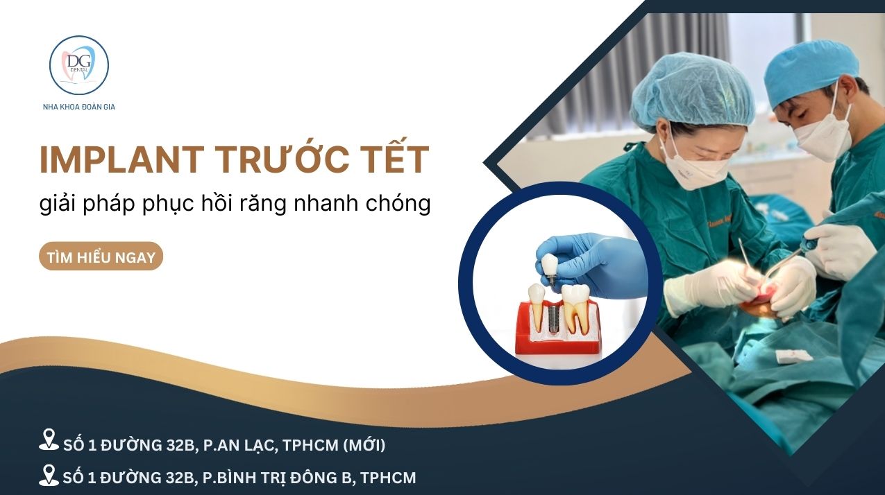 21. TRỒNG IMPLANT TRƯỚC TẾT  GIẢI PHÁP PHỤC HỒI RĂNG NHANH CHÓNG