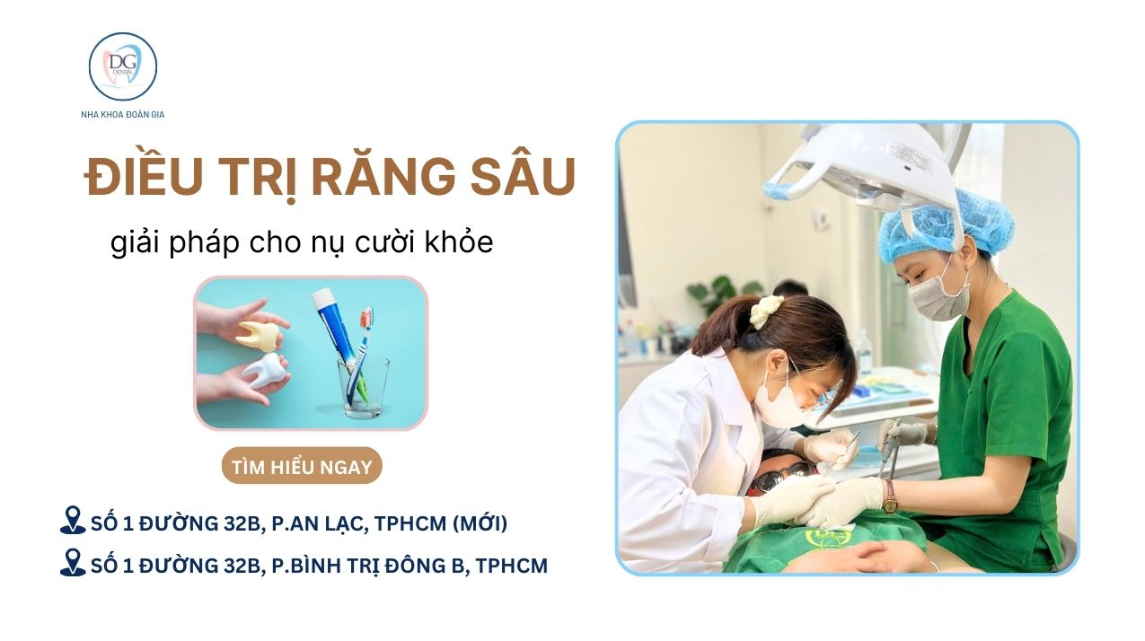 21. ĐIỀU TRỊ RĂNG SÂU SAU MÙA HÈ  GIẢI PHÁP CHO NỤ CƯỜI KHỎE