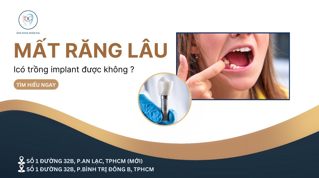 22. MẤT RĂNG LÂU NĂM CÓ TRỒNG IMPLANT ĐƯỢC KHÔNG