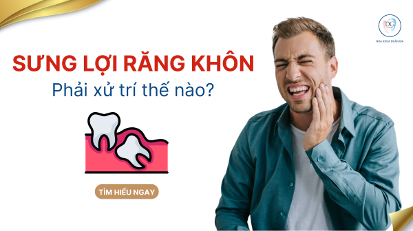 22. SƯNG NƯỚU RĂNG KHÔN PHẢI XỬ TRÍ THẾ NÀO