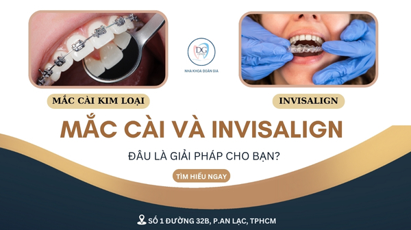 22.  MẮC CÀI VÀ INVISALIGN ĐÂU LÀ GIẢI PHÁP CHO BẠN