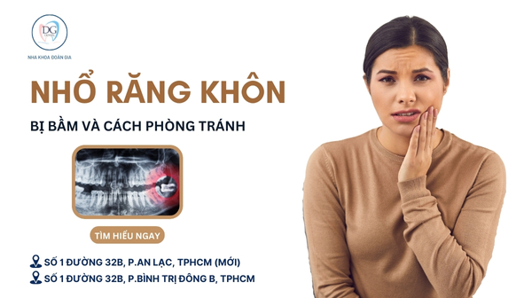 23. NHỔ RĂNG KHÔN CÓ BỊ TỤ MÁU KHÔNG  CÁCH PHÒNG TRÁNH