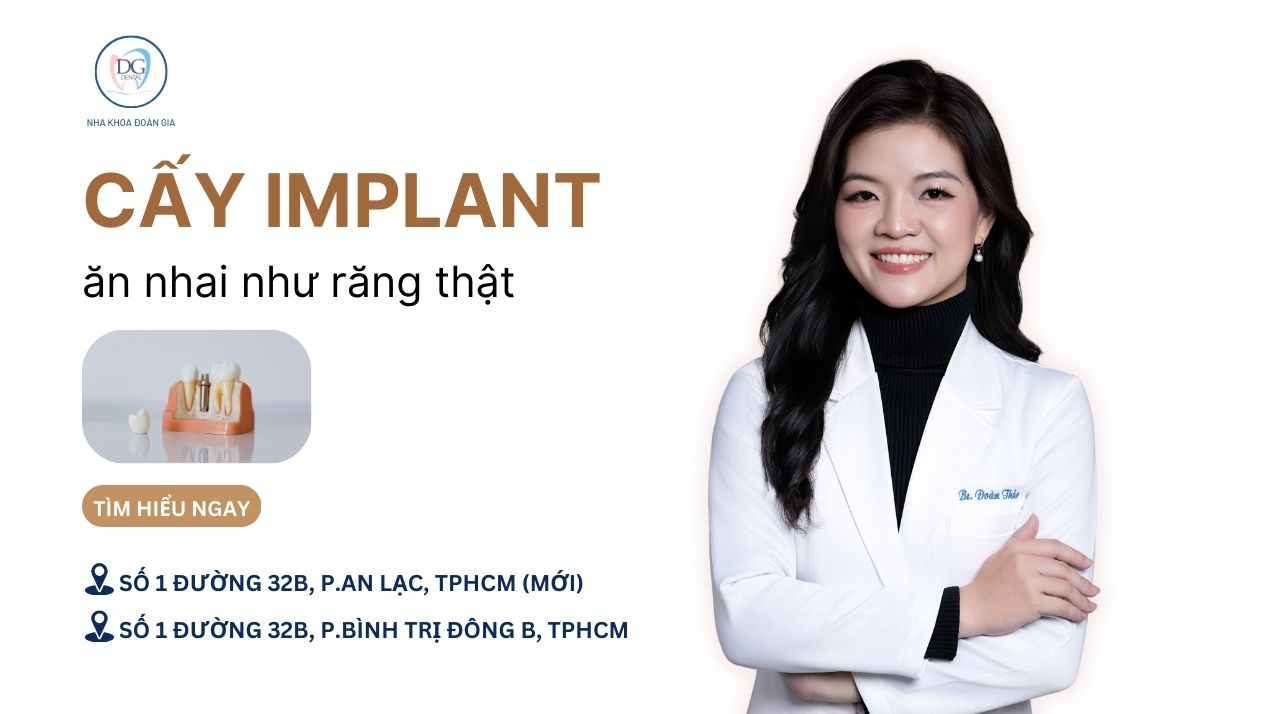 24. CẤY IMPLANT ĂN NHAI NHƯ RĂNG THẬT  SỰ THẬT HAY QUẢNG CÁO