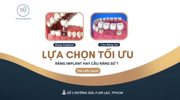 24. LỰA CHỌN TỐI ƯU RĂNG IMPLANT HAY CẦU RĂNG SỨ