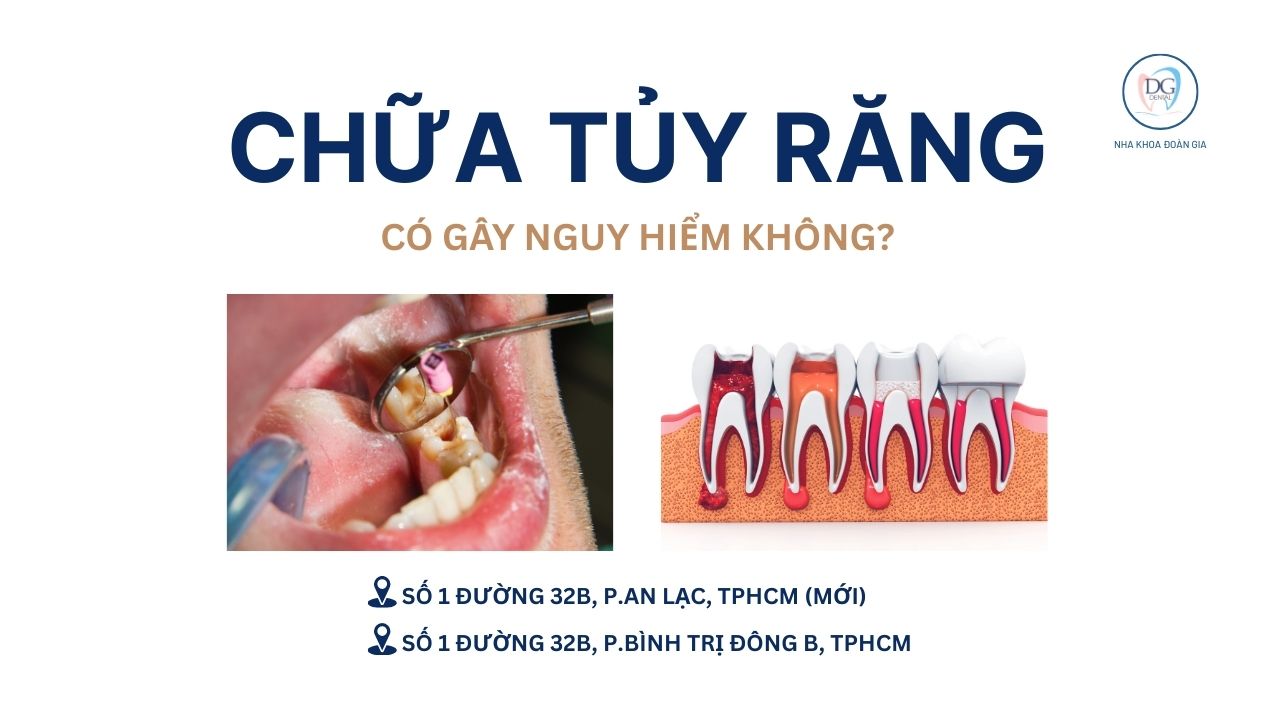 25. LẤY TỦY RĂNG CÓ NGUY HIỂM KHÔNG  GIẢI ĐÁP TỪ CHUYÊN GIA NHA KHOA