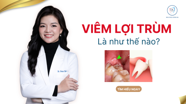25. VIÊM LỢI TRÙM LÀ NHƯ THẾ NÀO