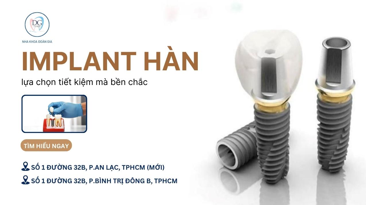 26. CẤY GHÉP IMPLANT HÀN QUỐC  LỰA CHỌN TIẾT KIỆM MÀ BỀN CHẮC