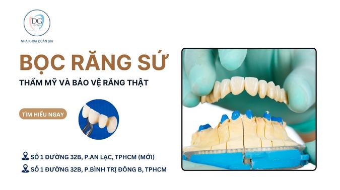 26. LỢI ÍCH KÉP KHI BỌC RĂNG SỨ THẨM MỸ VÀ BẢO VỆ RĂNG THẬT
