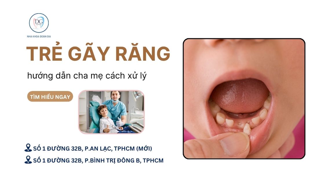 27. HƯỚNG DẪN CHA MẸ XỬ LÝ KHI TRẺ BỊ GÃY RĂNG