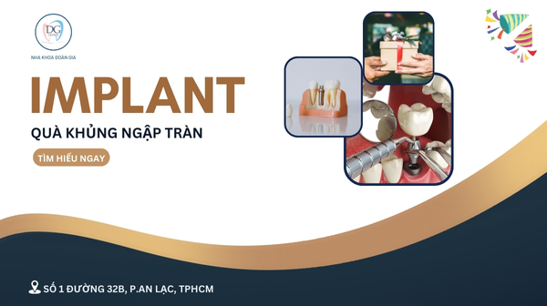 27. IMPLANT QUÀ KHỦNG NGẬP TRÀN