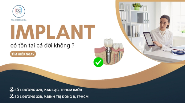 28. IMPLANT CÓ TỒN TẠI CẢ ĐỜI KHÔNG