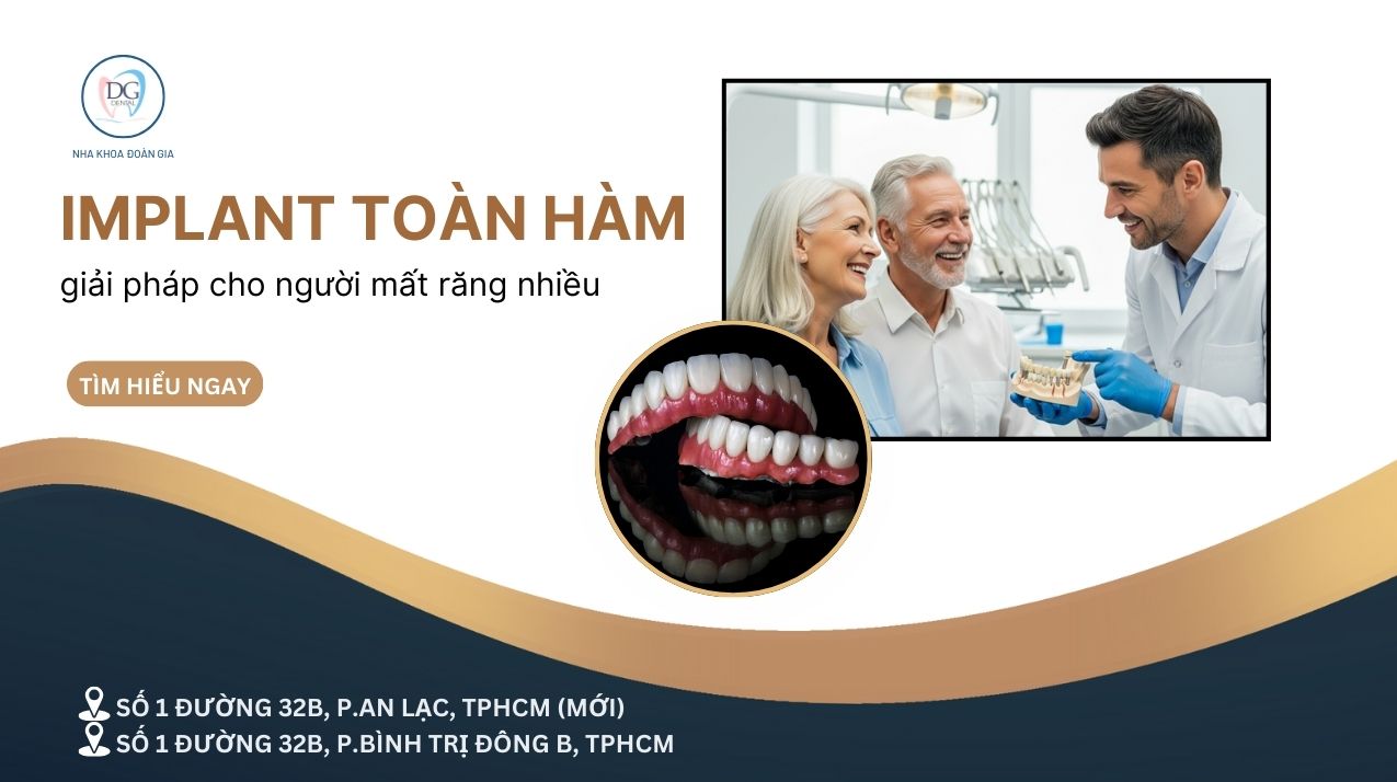 28. IMPLANT TOÀN HÀM  GIẢI PHÁP CHO NGƯỜI MẤT RĂNG NHIỀU