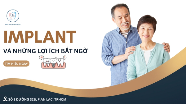 29. IMPLANT VÀ NHỮNG LỢI ÍCH BẤT NGỜ