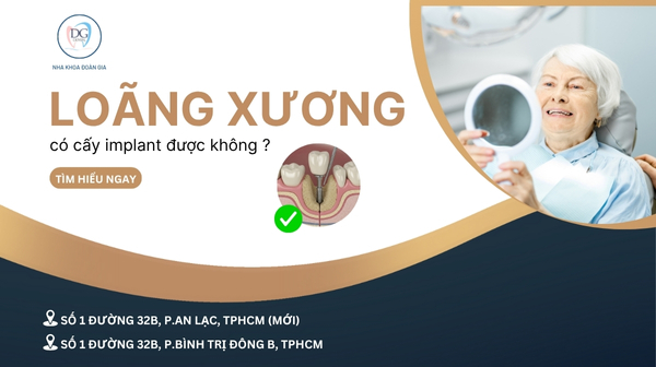 29. NGƯỜI BỊ LOÃNG XƯƠNG CÓ CẤY IMPLANT ĐƯỢC KHÔNG
