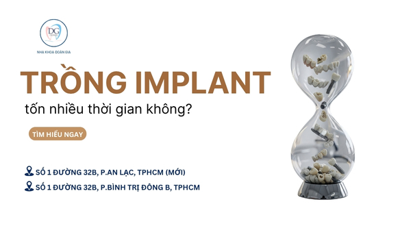 29. TRỒNG RĂNG IMPLANT MẤT BAO LÂU  CÓ LÀM LIỀN ĐƯỢC KHÔNG