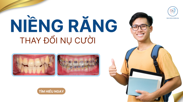 3. NIỀNG RĂNG - NỤ CƯỜI ĐẸP CƠ HỘI MỞ RỘNG