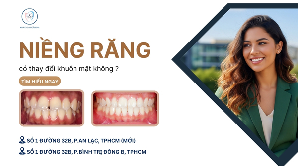3. NIỀNG RĂNG CÓ THAY ĐỔI KHUÔN MẶT KHÔNG