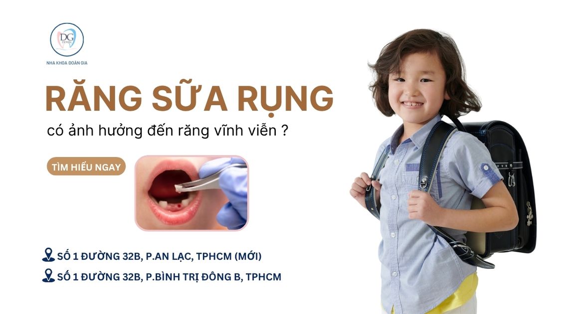 30. RĂNG SỮA RỤNG SỚM ẢNH HƯỞNG NHƯ THẾ NÀO ĐẾN RĂNG VĨNH VIỄN