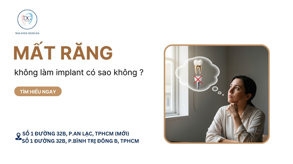 31. MẤT RĂNG HÀM SỐ 6  KHÔNG LÀM IMPLANT CÓ SAO KHÔNG