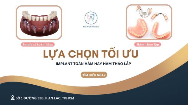 32.IMPLANT TOÀN HÀM KHẮC GÌ HÀM GIẢ THÁO LẮP