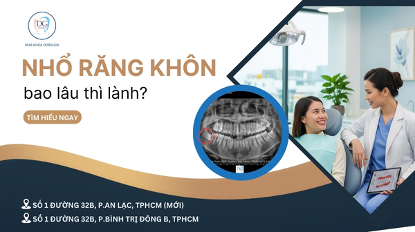 32. NHỔ RĂNG KHÔN CÓ NGUY HIỂM KHÔNG  BAO LÂU THÌ LÀNH