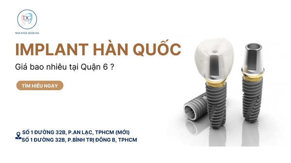 32. TRỒNG IMPLANT HÀN QUỐC TẠI QUẬN 6  GIÁ BAO NHIÊU