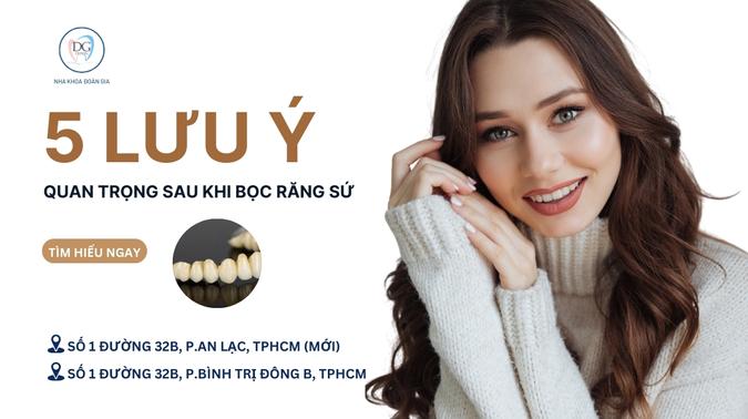 34. 5 LƯU Ý QUAN TRỌNG SAU KHI BỌC RĂNG SỨ ĐỂ DUY TRÌ LÂU BỀN