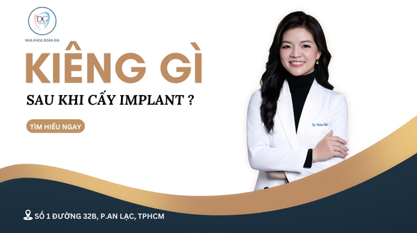 34. KIÊNG GÌ SAU KHI CẤY GHÉP IMPLANT   bản 2