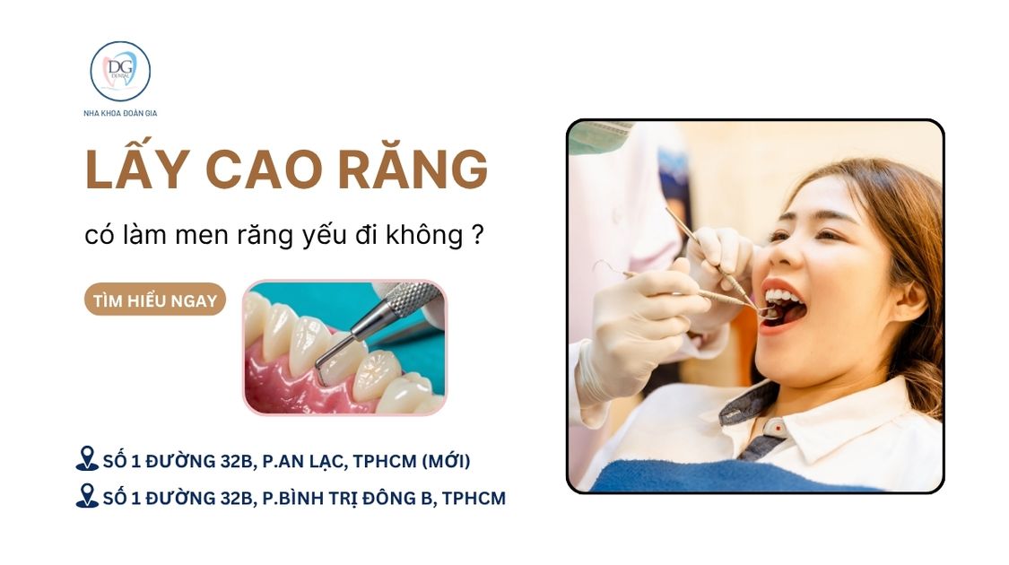 34. VÌ SAO CẦN LẤY CAO RĂNG ĐỊNH KỲ ĐỂ NGỪA VIÊM NƯỚU