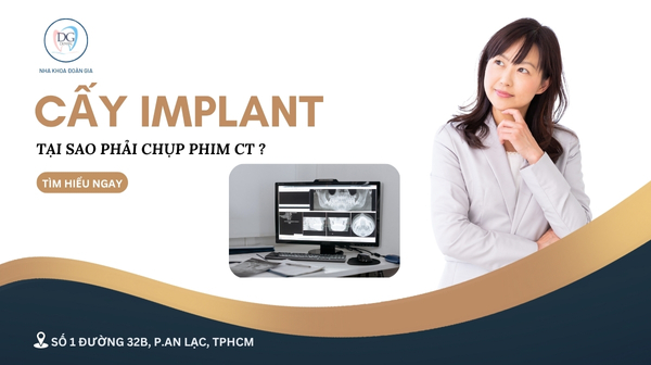 35. TẠI SAO TRỒNG IMPLANT PHẢI CHỤP CT