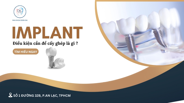 37. LÀM SAO BIẾT MÌNH ĐỦ ĐIỀU KIỆN CẤY GHÉP IMPLANT