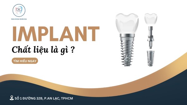38. CHẤT LIỆU CỦA IMPLANT LÀ GÌ