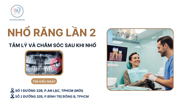 4. NHỔ RĂNG KHÔN LẦN 2  TÂM LÝ VÀ CHĂM SÓC SAU KHI NHỔ