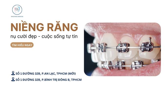 4. NIỀNG RĂNG NỤ CƯỜI ĐẸP SỰ NGHIỆP THÀNH CÔNG CUỘC SỐNG TỰ TIN